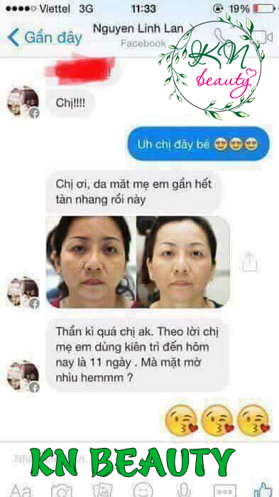bộ trị nám