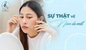 Giải Mã Nguyên Nhân Gây Nám Da Bạn Chưa Biết Tới
