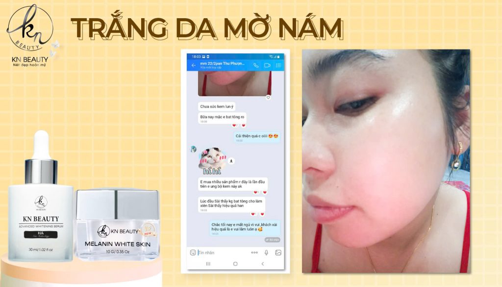 Khách Hàng Nói Gì Về Kem Face & Serum KN BEAUTY?