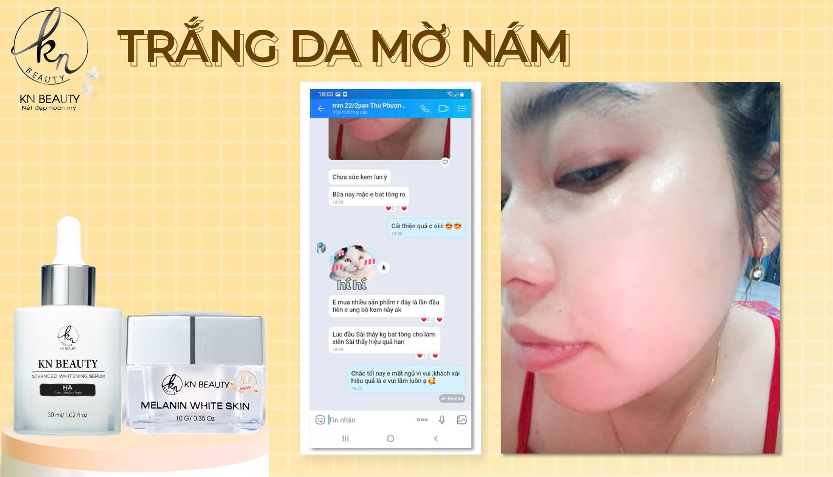 Hình ảnh trước và sau khi sử dụng Kem Face và Serum KN BEAUTY